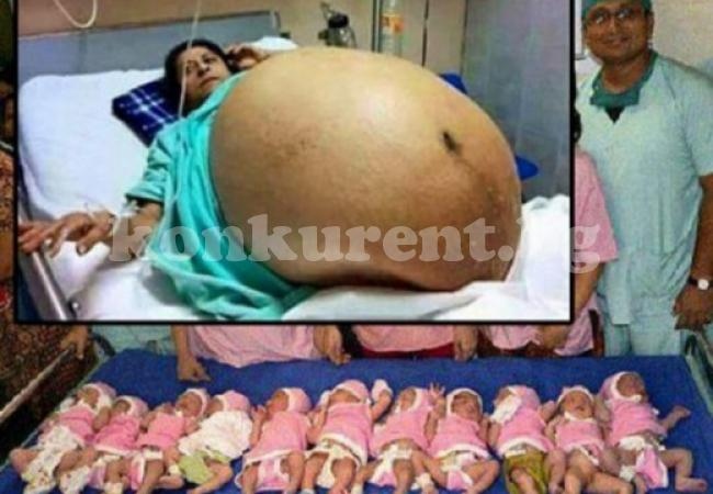 42-годишна жена роди 11 деца за 37 минути