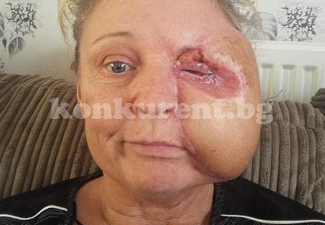 Жена се удари в печка и изгуби половината от лицето си заради нещо страшно (СНИМКИ)  