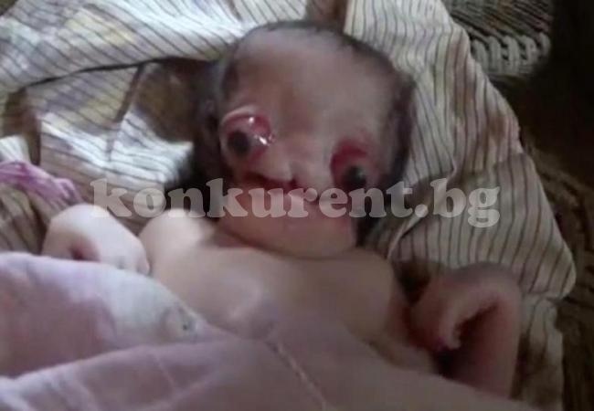 Жена роди в дома си, но съседи видяха бебето и се втрещиха: Извънземно е! Шокиращи СНИМКИ (18+)  