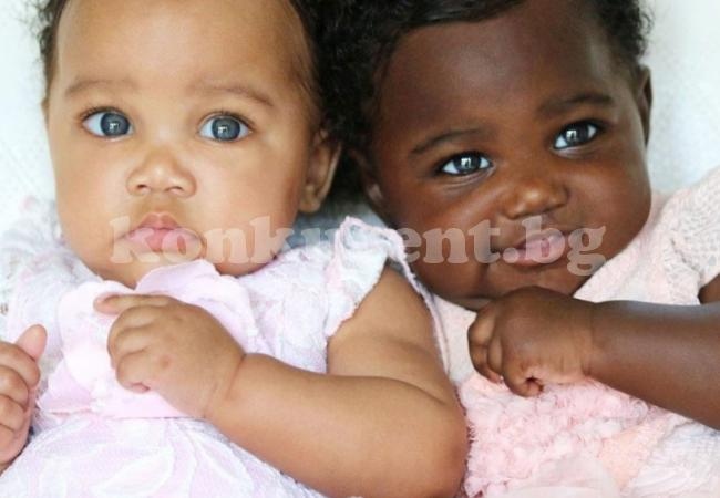Тези близначки са едва на 7 месеца, но вече са световна знаменитост с хиляди фенове, причината е невероятна! (СНИМКИ) 