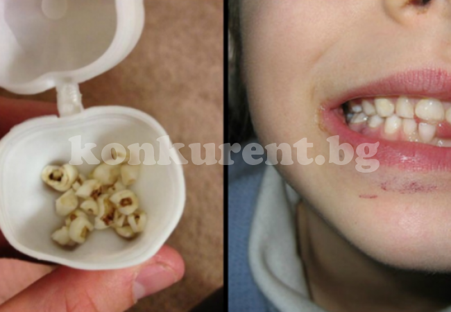 Не изхвърляйте млечните зъби на децата, може да спасят живота им