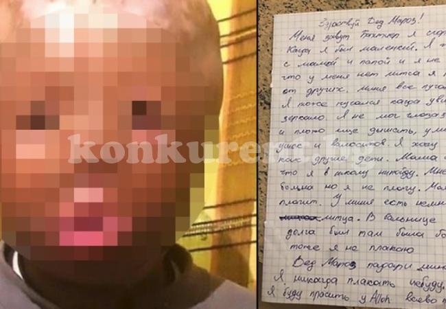 Изгорено момченце написа сърцераздирателно писмо до Дядо Коледа (СНИМКИ 18+)