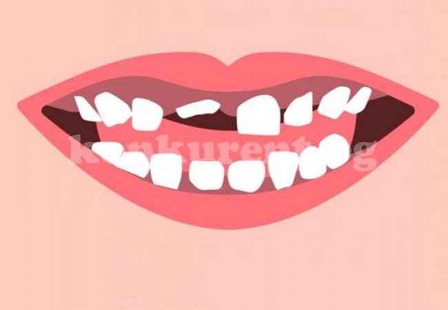 8-те най-лоши неща за зъбите