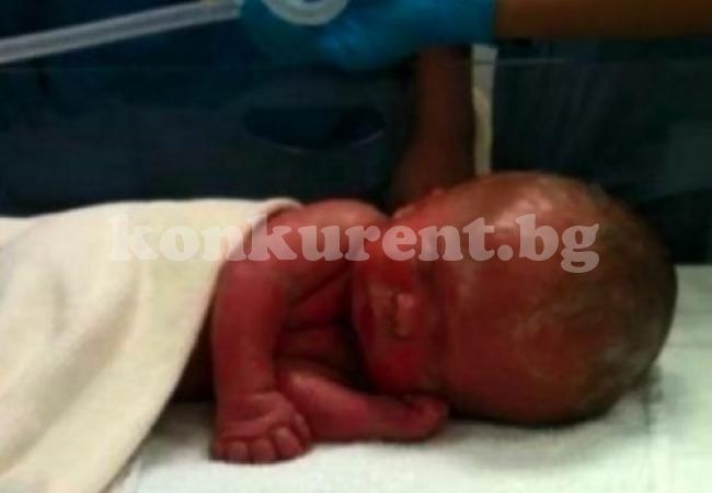 Бебето от тази СНИМКА шокира целия свят, а историята му е истинско чудо
