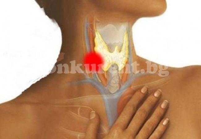 Назоваха основните симптоми на рак на гърлото