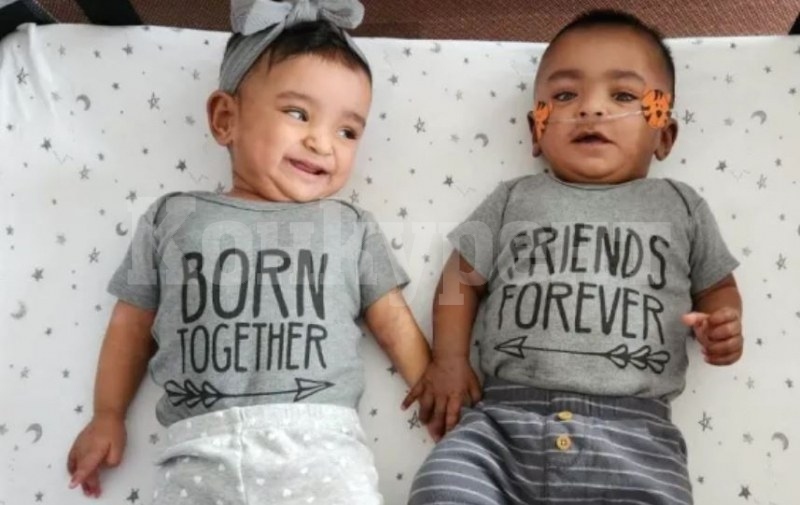 Оцеляха близнаци с 0% шанс за живот!