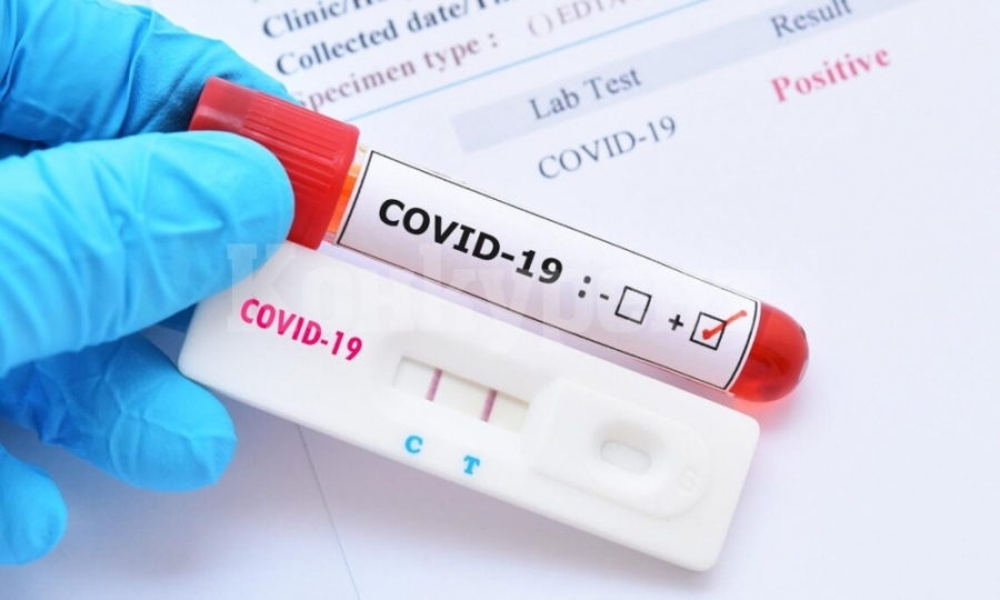 43 нови случаи на коронавирус, няма починали